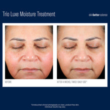 Load image into Gallery viewer, SkinBetter Trio Luxe Moisture Treatment 50ml