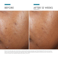 Load image into Gallery viewer, SkinCeuticals Phyto A+ Brightening Treatment