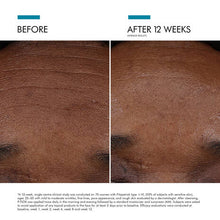 Load image into Gallery viewer, SkinCeuticals P-TIOX Anti-Wrinkle Serum