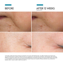 Load image into Gallery viewer, SkinCeuticals P-TIOX Anti-Wrinkle Serum