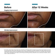 Load image into Gallery viewer, SkinCeuticals A.G.E. Interrupter Ultra Serum