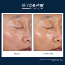 Load image into Gallery viewer, SkinBetter Science® Duo Kit 30ml