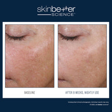 Load image into Gallery viewer, SkinBetter Science® AlphaRet Overnight Cream 30ml