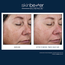 Load image into Gallery viewer, SkinBetter Science® Alto Advanced Defense and Repair Serum  30ml