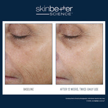 Load image into Gallery viewer, SkinBetter Science® Even Tone Correcting Serum 50ml