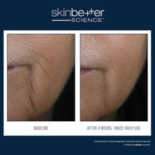 Load image into Gallery viewer, SkinBetter InterFuse Intensive Treatment LINES 15ml