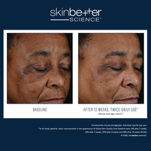 Load image into Gallery viewer, SkinBetter Science® Mystro Active Balance Serum 30ml