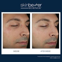 Load image into Gallery viewer, SkinBetter Solo Hydrating Defense MEN 50ml