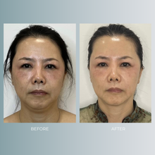 将图片加载到图库查看器,ThermageFLX | up to 20% OFF