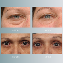 将图片加载到图库查看器,EmFace | 30% OFF