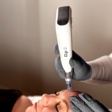 将图片加载到图库查看器,Microneedling | 35% OFF