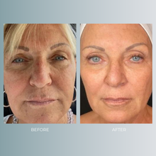 将图片加载到图库查看器,Tixel | 35% OFF