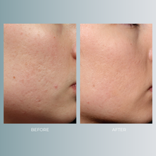 将图片加载到图库查看器,Exion Face | 35% OFF