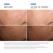 Load image into Gallery viewer, SkinCeuticals Discoloration Defense