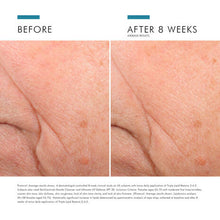 Load image into Gallery viewer, SkinCeuticals Triple Lipid Restore 2:4:2