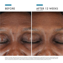 Load image into Gallery viewer, SkinCeuticals A.G.E. Interrupter Advanced