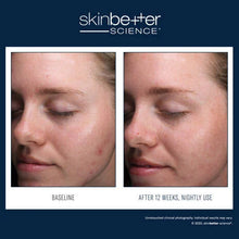 Load image into Gallery viewer, SkinBetter AlphaRet Clearing Serum 30ml
