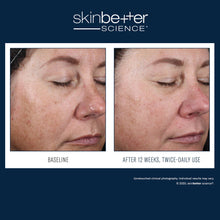 Load image into Gallery viewer, skinbetter science® Alto Advanced Defense and Repair Serum  15ml
