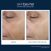 Load image into Gallery viewer, skinbetter science® Even Tone Correcting Serum 50ml
