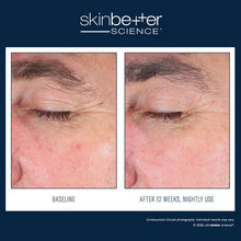 Load image into Gallery viewer, SkinBetter EyeMax AlphaRet Overnight Cream 15ml
