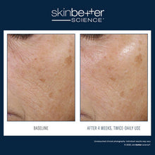 Load image into Gallery viewer, SkinBetter Trio Rebalancing Moisture Treatment 50ml
