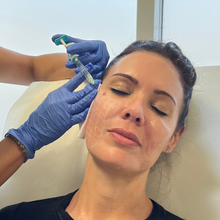 将图片加载到图库查看器，SkinVive | 25% OFF
