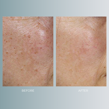 将图片加载到图库查看器，Enlighten | 40% OFF
