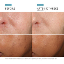 Load image into Gallery viewer, SkinCeuticals PHLORETIN CF® WITH FERULIC ACID

