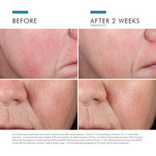 Load image into Gallery viewer, SkinCeuticals PHYTO CORRECTIVE ESSENCE MIST
