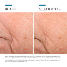 Load image into Gallery viewer, SkinCeuticals TRIPLE LIPID RESTORE 2:4:2
